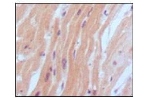 Immunohistochemical analysis of paraffin-embedded human normal myocardium, showing cytoplasmic localization using BNP2 antibody with DAB staining. (BNP antibody)