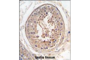 Formalin-fixed and paraffin-embedded human testis tissue reacted with SPAG9 antibody , which was peroxidase-conjugated to the secondary antibody, followed by DAB staining. (SPAG9 antibody  (AA 603-632))