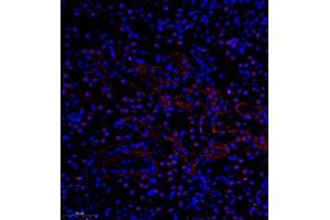 Immunofluorescence of paraffin embedded mouse nephritis using pax2 (ABIN7074974) at dilution of 1:600 (300x lens) (PAX2A antibody)