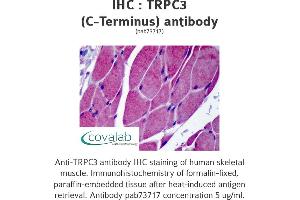 Image no. 1 for anti-Transient Receptor Potential Cation Channel, Subfamily C, Member 3 (TRPC3) antibody (ABIN1740387) (TRPC3 antibody)