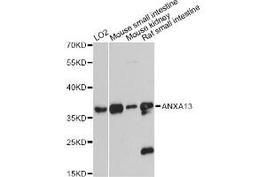 Western blot analysis of extracts of various cell lines, using ANXA13 antibody. (Annexin A13 antibody)