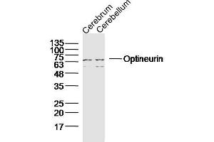 Lane 1: Mouse Cerebrum lysates; Lane 2: Mouse cerebellum; probed with Optineurin Polyclonal Antibody, unconjugated (bs-13658R) at 1:300 overnight at 4°C followed by a conjugated secondary antibody for 60 minutes at 37°C. (OPTN antibody  (AA 341-440))