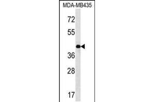 Western blot analysis in MDA-MB435 cell line lysates (35ug/lane). (SERPINE2 antibody  (AA 106-135))