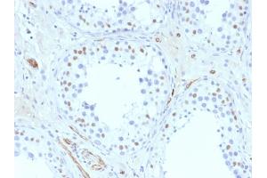 Formalin-fixed, paraffin-embedded human Testis stained with Wilm's Tumor Mouse Monoclonal Antibody (6F-H2). (WT1 antibody  (AA 1-181))