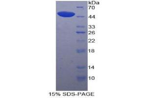 SDS-PAGE (SDS) image for Lipoprotein-Associated phospholipase A2 (Lp-PLA2) (AA 22-444) protein (His tag) (ABIN2121890) (PLA2G7 Protein (AA 22-444) (His tag))