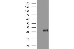 Western Blotting (WB) image for anti-Adiponectin (ADIPOQ) (AA 19-244) antibody (ABIN2715783) (ADIPOQ antibody  (AA 19-244))
