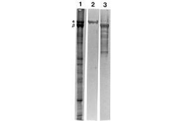 Spectrin beta Chain, Erythrocyte (SPTB) antibody