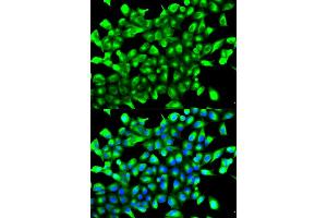 Immunofluorescence analysis of MCF-7 cells using EGLN1 antibody. (EGLN1 antibody)