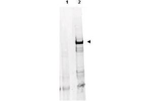 Western Blotting (WB) image for anti-Ataxia Telangiectasia Mutated (ATM) (AA 1974-1988), (pSer1981) antibody (HRP) (ABIN6656106)