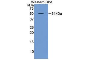 Western Blotting (WB) image for anti-Proteasome (Prosome, Macropain) 26S Subunit, ATPase, 4 (PSMC4) (AA 1-418) antibody (ABIN1860337) (PSMC4 antibody  (AA 1-418))