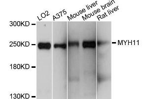 Western blot analysis of extracts of various cell lines, using MYH11 antibody (ABIN5998290) at 1/1000 dilution. (MYH11 antibody)