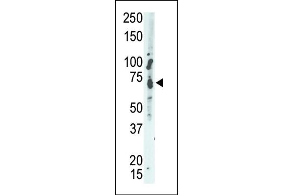 PTPN9 antibody  (C-Term)