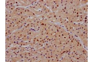 Immunohistochemistry (IHC) image for anti-Mitogen-Activated Protein Kinase 14 (MAPK14) antibody (ABIN7127654)