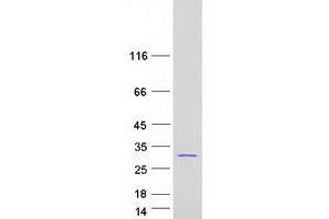 Validation with Western Blot (CCDC169 Protein (Transcript Variant 1) (Myc-DYKDDDDK Tag))