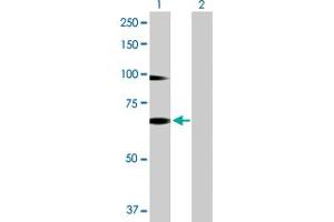 Western Blot analysis of RNF12 expression in transfected 293T cell line by RNF12 MaxPab polyclonal antibody. (RLIM antibody  (AA 1-624))