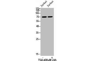 Western blot analysis of JK lysis using Acetyl-Ku-70 (K542) antibody. (XRCC6 antibody  (acLys542))