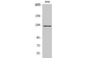 Western Blotting (WB) image for anti-PTK2 Protein tyrosine Kinase 2 (PTK2) (Thr435) antibody (ABIN3184580) (FAK antibody  (Thr435))