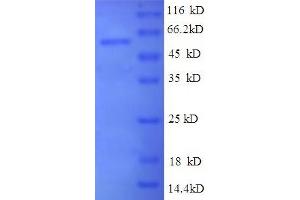 SDS-PAGE (SDS) image for Ribonuclease, RNase A Family, 4 (RNASE4) (AA 2-247), (partial) protein (GST tag) (ABIN4974200) (RNASE4 Protein (AA 2-247, partial) (GST tag))