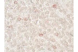 Immunohistochemistry analysis of human tonsil tissue (60x) using LAG-3 (human) recombinant mAb (L4-PL33), at a dilution of 1:50 (LAG3 antibody  (N-Term))