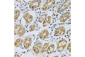 Immunohistochemistry of paraffin-embedded human stomach using SERPINB5 Antibody (ABIN6292701) at dilution of 1:200 (40x lens). (SERPINB5 antibody)