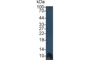 Detection of PF4 in Human Lymphocyte lysate using Monoclonal Antibody to Platelet Factor 4 (PF4) (PF4 antibody  (AA 31-101))