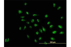 Immunofluorescence of purified MaxPab antibody to D21S2056E on HeLa cell. (RRP1 antibody  (AA 1-461))