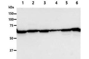 The Cell lysates (40ug) were resolved by SDS-PAGE, transferred to PVDF membrane and probed with anti-human PGM1 antibody (1:1000). (Phosphoglucomutase 1 antibody)