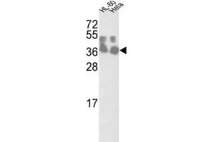 Western Blotting (WB) image for anti-Chloride Channel, Nucleotide-Sensitive, 1A (CLNS1A) antibody (ABIN3002661) (CLNS1A antibody)