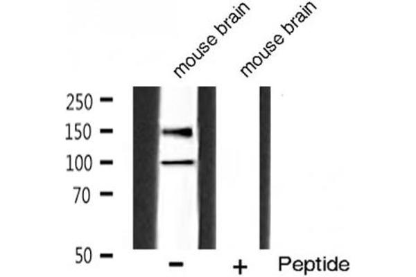 IGF1R antibody  (pTyr1165, pTyr1166)