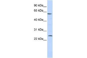 SLC18A1 antibody used at 0. (SLC18A1 antibody  (Middle Region))