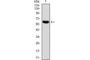 Western blot analysis using TIE1 mAb against human TIE1 (AA: 385-607) recombinant protein. (TIE1 antibody  (AA 385-607))