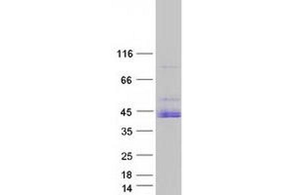 PRKACA Protein (Transcript Variant 2) (Myc-DYKDDDDK Tag)