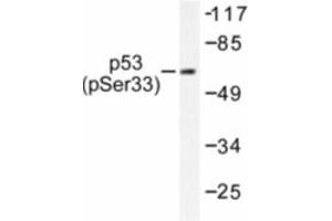 Image no. 1 for anti-Tumor Protein P53 (TP53) (pSer33) antibody (ABIN318093) (p53 antibody  (pSer33))