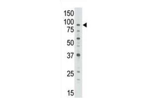 Western Blotting (WB) image for anti-ATP-Binding Cassette, Sub-Family B (MDR/TAP), Member 7 (ABCB7) antibody (ABIN3002511) (ABCB7 antibody)