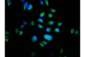 Immunofluorescence staining of Hela cells with ABIN7162762 at 1:100, counter-stained with DAPI. (MTRF1 antibody  (AA 285-433))
