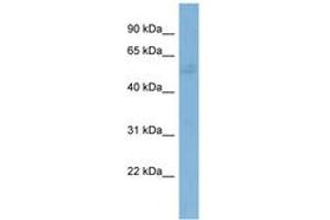 Image no. 1 for anti-GTPase Activating Protein (SH3 Domain) Binding Protein 1 (G3BP1) (AA 107-156) antibody (ABIN6742009) (G3BP1 antibody  (AA 107-156))