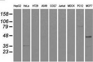 Western blot analysis of extracts (35 µg) from 9 different cell lines by using anti-CD4 monoclonal antibody. (CD4 antibody)