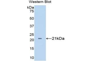 Detection of Recombinant TNFa, Porcine using Polyclonal Antibody to Tumor Necrosis Factor Alpha (TNFa) (TNF alpha antibody  (AA 77-232))