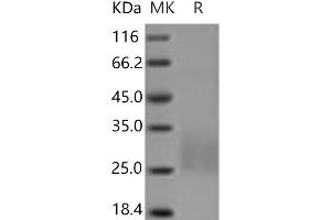 Western Blotting (WB) image for Regenerating Islet-Derived Family, Member 4 (REG4) protein (His tag) (ABIN7321169) (REG4 Protein (His tag))