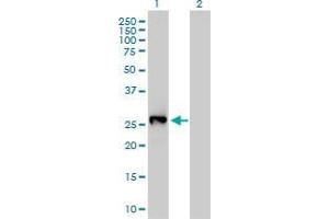 Western Blot analysis of LXN expression in transfected 293T cell line by LXN monoclonal antibody (M01), clone 8H5. (Latexin antibody  (AA 151-222))
