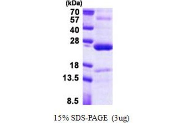 TNFAIP8 Protein (AA 1-198) (His tag)