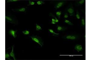 Immunofluorescence of purified MaxPab antibody to PCNA on HeLa cell. (PCNA antibody  (AA 1-261))