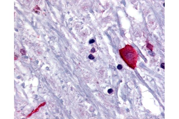 BRS3 antibody  (N-Term)