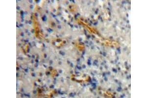 Used in DAB staining on fromalin fixed paraffin-embedded kidney tissue (AGR2 antibody  (AA 21-175))