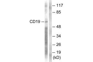 Western Blotting (WB) image for anti-CD19 Molecule (CD19) (Tyr531) antibody (ABIN1847934) (CD19 antibody  (Tyr531))