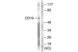 Western Blotting (WB) image for anti-CD19 Molecule (CD19) (Tyr531) antibody (ABIN1847935) (CD19 antibody  (Tyr531))