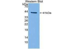 Detection of Recombinant TFR2, Human using Polyclonal Antibody to Transferrin Receptor 2 (TFR2) (Transferrin Receptor 2 antibody  (AA 604-703))