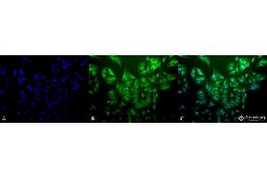 Immunocytochemistry/Immunofluorescence analysis using Mouse Anti-Ubiquitin Monoclonal Antibody, Clone 5B9-B3 . (Ubiquitin antibody  (Atto 594))