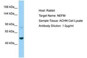 Image no. 1 for anti-Neurofilament Triplet M Protein (NEFM) (AA 429-478) antibody (ABIN6750015) (NEFM antibody  (AA 429-478))