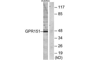 Western Blotting (WB) image for anti-G Protein-Coupled Receptor 151 (GPR151) (C-Term) antibody (ABIN1852899) (GPR151 antibody  (C-Term))